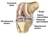 Разрыв заднего рога медиального мениска коленного сустава — лечение, симптомы, полный анализ травмы Рога мениска